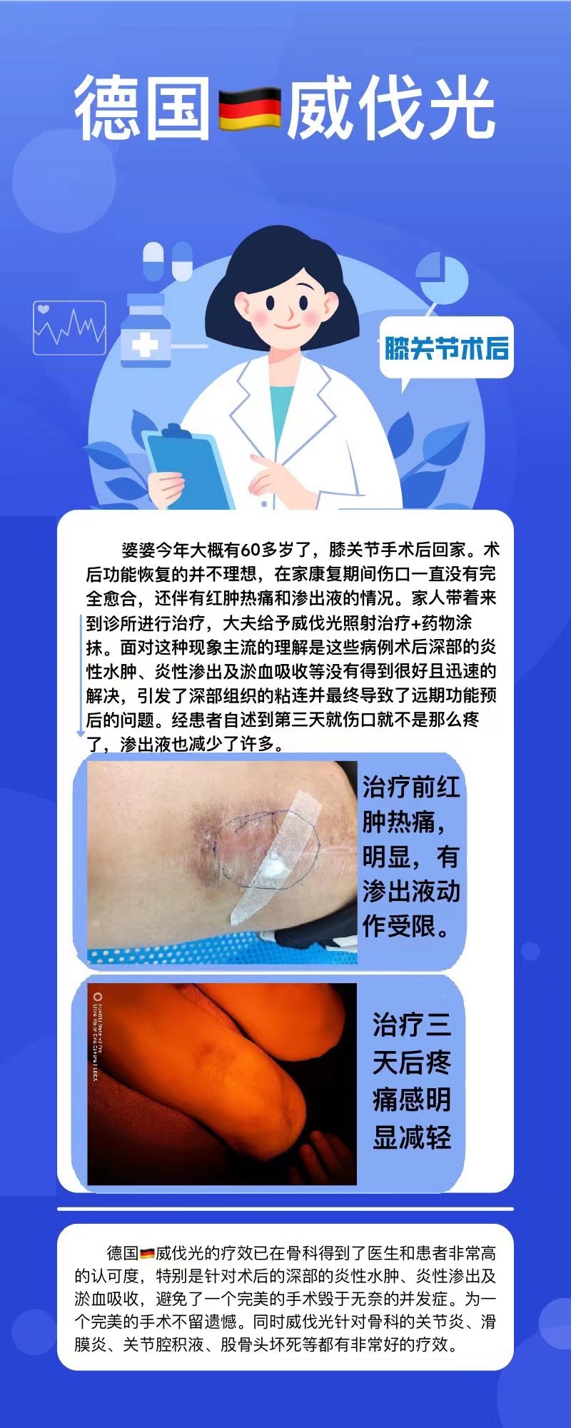 威伐光——膝关节置换术后（0623）